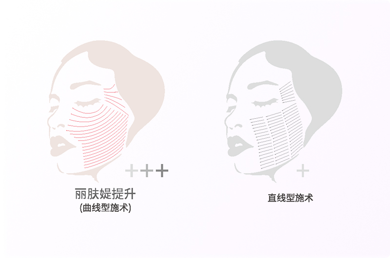 曲线提拉